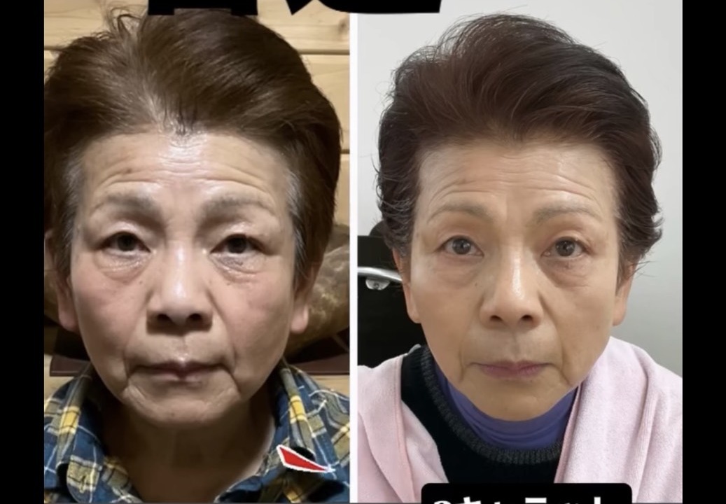 2カラット使用後の変化