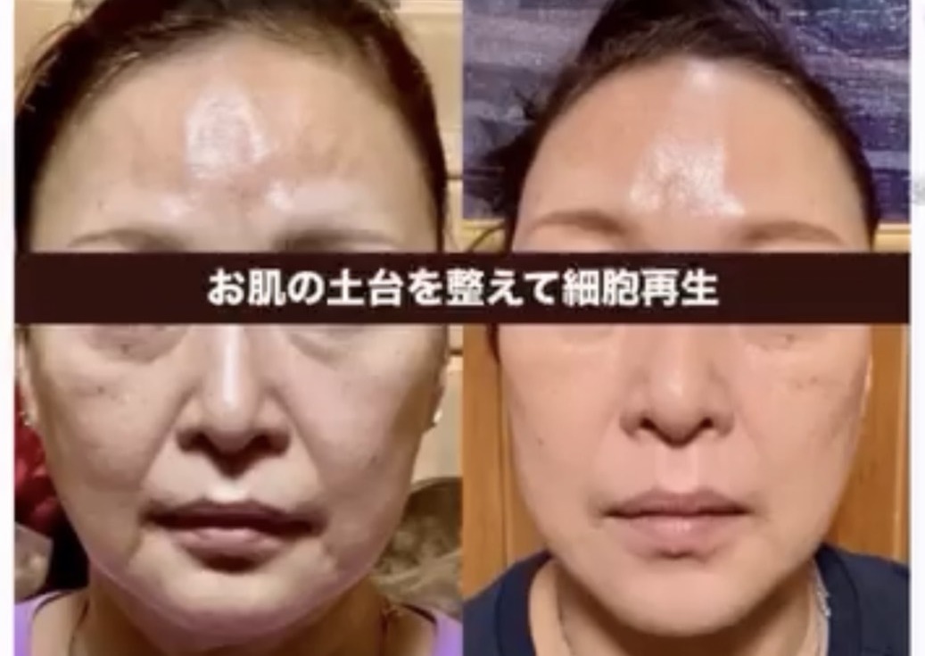 たった1回でこの変化 5日後ダイヤオフ