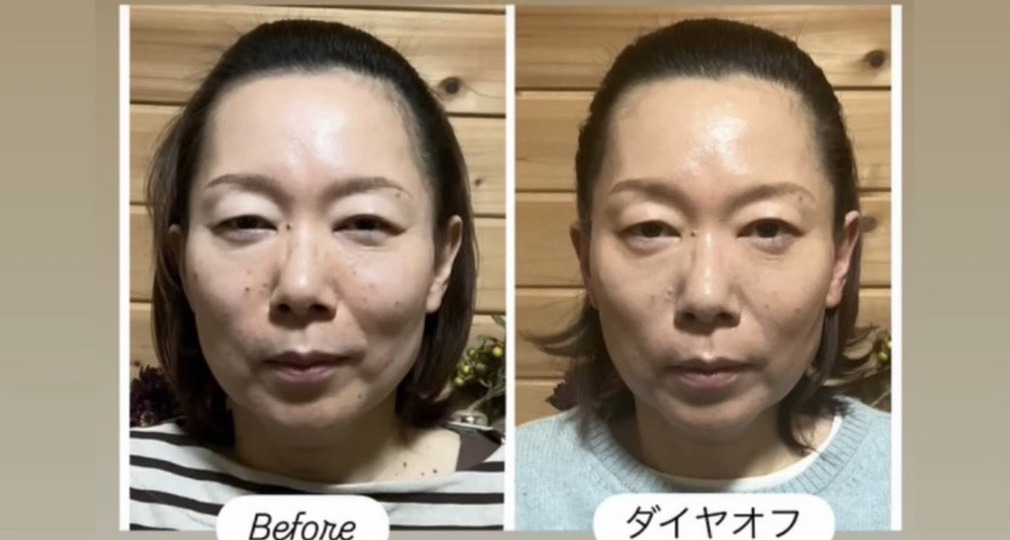 Before ダイヤオフ 花水木さん