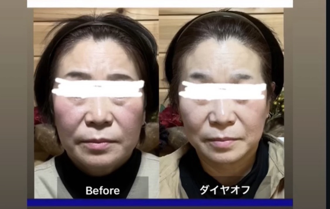 Before ダイヤオフ 花水木さん 目元は伏せ